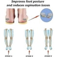 thumbnail image 3 of Supination Insoles For Over Supination High Arch Support, Orthotic Inserts For Men Women, Corrective Foot Supports For Supination Relief, 3 of 5