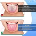 thumbnail image 3 of 3pcs Sc Bad Remove Hygiene Bru Set, 3 of 5