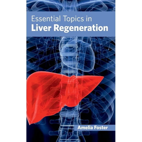 Essential Topics in Liver Regeneration, (Hardcover)
