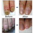 thumbnail image 2 of 1、Ingredientes farmacéuticos:, 2 of 5