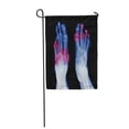 thumbnail image 1 of SIDONKU X Ray of Diabetic Feet Posterior View Show Amputation Toes and Joint Inflamed Garden Flag Decorative Flag House Banner 28x40 inch, 1 of 1