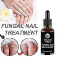thumbnail image 2 of Powerful Nail Fungus Care Repair Liquid Professional Cuticle Oi, 2 of 4
