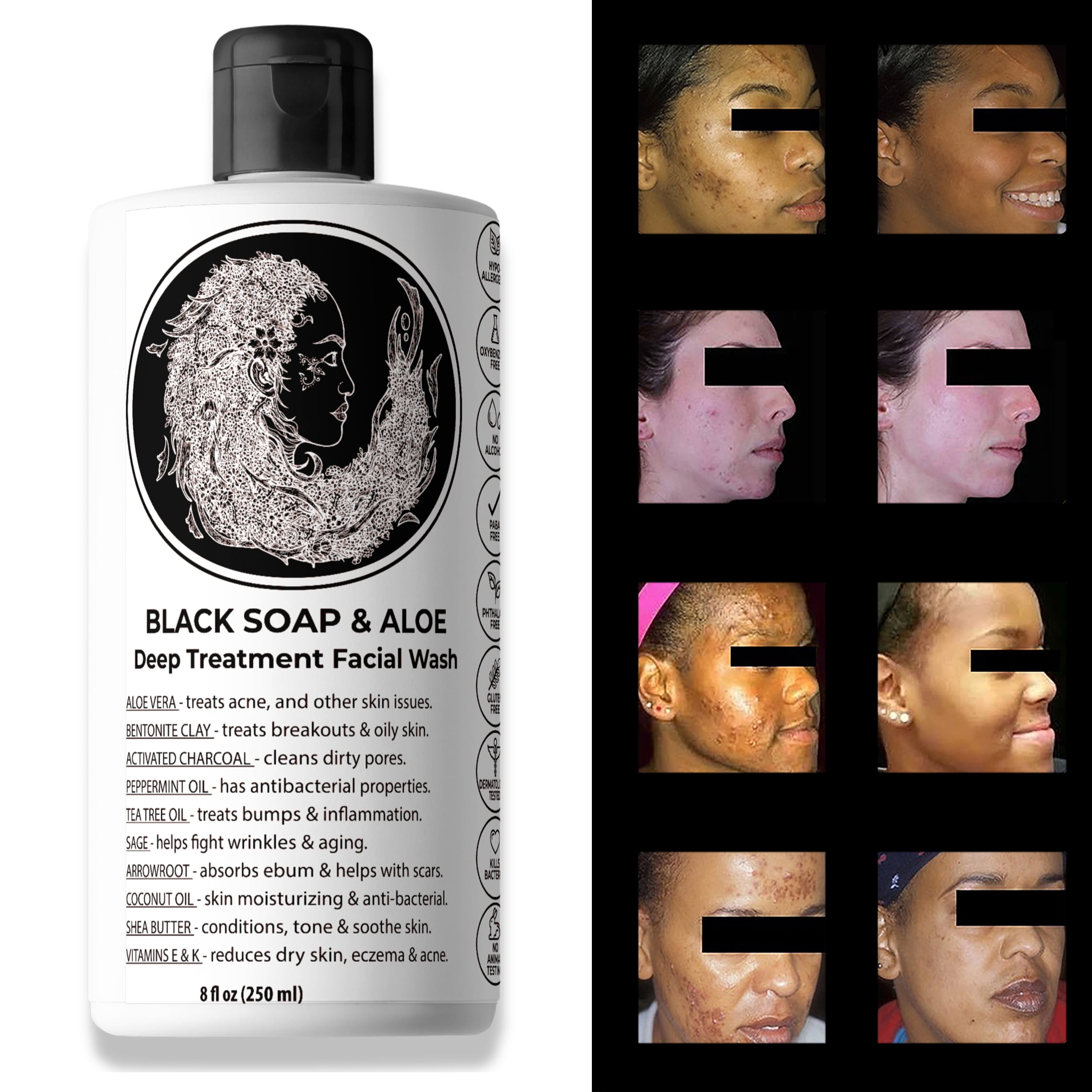 Natural Black Soap with Aloe  8 oz Acne Treatment  Dark Spot Remover for Face  Body Paraben Free  All Natural Ingredients Liquid Soap This Soap Works LLC