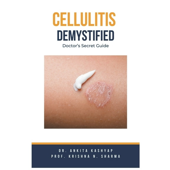 Cellulitis Demystified: Doctor's Secret Guide, (Paperback)