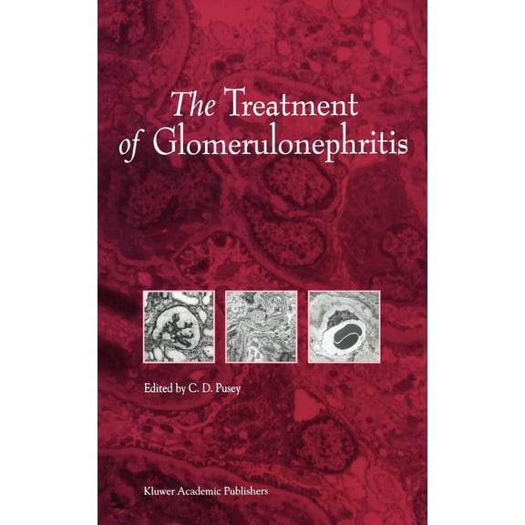 Developments in Nephrology The Treatment of Glomerulonephritis, Book 40, (Hardcover)