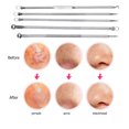thumbnail image 4 of Kit de agujas para espinillas y puntos negros Labymos 5 uds Cuidado e Higiene, 4 of 7