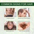 thumbnail image 2 of IBeaLee Herbal Hair Growth essence Hair Oil Hair Growth Agent Hair Nutrition Liquid, 2 of 5
