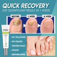 2PCS Toe Nail Fungus Treatment Repair Gel,Nail Fungus Treatment for