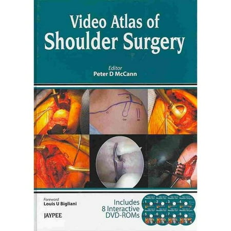 Video Atlas of Shoulder Surgery