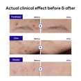 thumbnail image 3 of Tratamiento para árboles de té Spot Patch Mediheal Derma Clear, 132 parches, 3 of 8