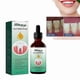thumbnail image 1 of 1-3pcs Quickly Gum Repair Serum Drops Relieve Receding Gum Periodontal Blistering Care Teeth Whiten Remove Yellow Toothache Toothpaste, 1 of 5