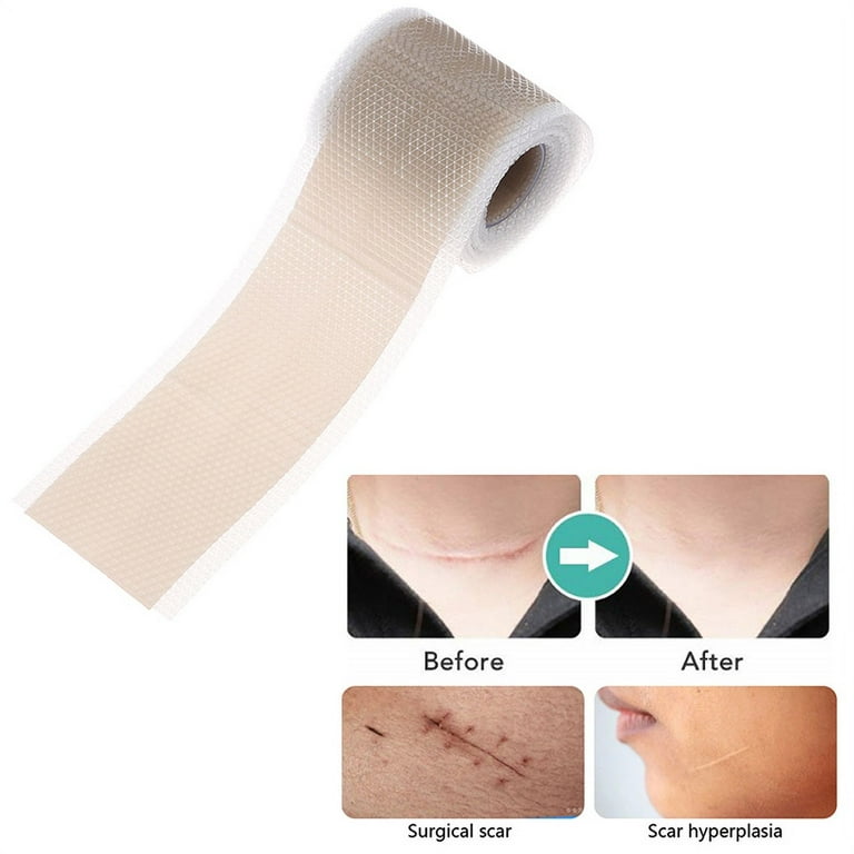 Scar bandage 2024