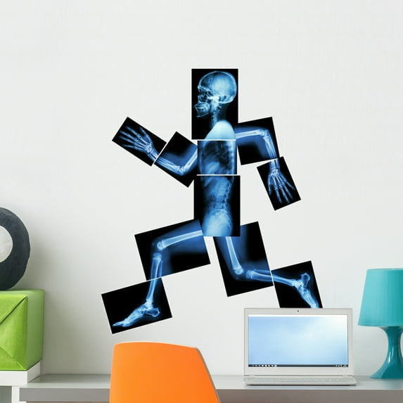 Aerobic Exercise Human Bone Wall Decal by Wallmonkeys Peel and Stick Graphic (24 in H x 20 in W) WM2461