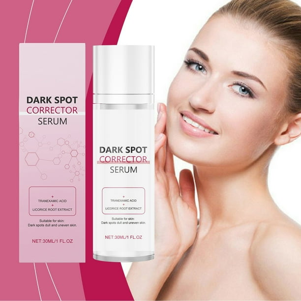 Fiudx Crema para Pecas, Crema Reparadora Melanina Que Difumina Las Manchas, Esencia Suave para Aclarar La Pie, Uso Diario, Ideal para Pie Sensible, Solución de Larga Duración 30 Ml