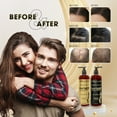 thumbnail image 4 of Shiny Leaf DHT Pro Shampoo - Anti-Thinning Shampoo for Men and Women, Shampoo for All Hair Types, ft. Procapil, Capixyl for Thicker Hair, 16 fl. oz, 4 of 11