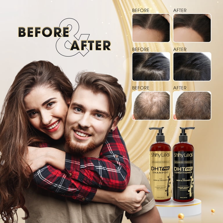 Shiny Leaf DHT Pro Shampoo, Anti-Thinning for Men and Women, All