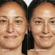 thumbnail image 3 of Maquillaje Even Better de Foundation Clinique, SPF 15, amplio espectro, 3 of 6