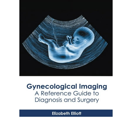 UPC: 9781639270712 | Gynecological Imaging: A Reference Guide to Diagnosis and Surgery (Hardcover)