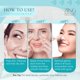 thumbnail image 5 of Parches nasales ZING SKIN CARE Prime Patch Hydrocolloid, 10 unidades, 5 of 7
