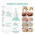 thumbnail image 1 of 30ml Anti Ingrown Hair Serum Razor Bump Treatment After Shave Solution, 1 of 9