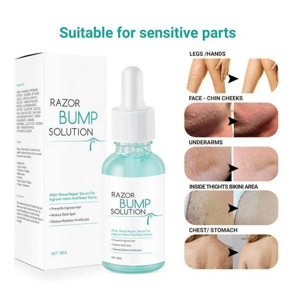 30ml Anti Ingrown Hair Serum Razor Bump Treatment After Shave Solution