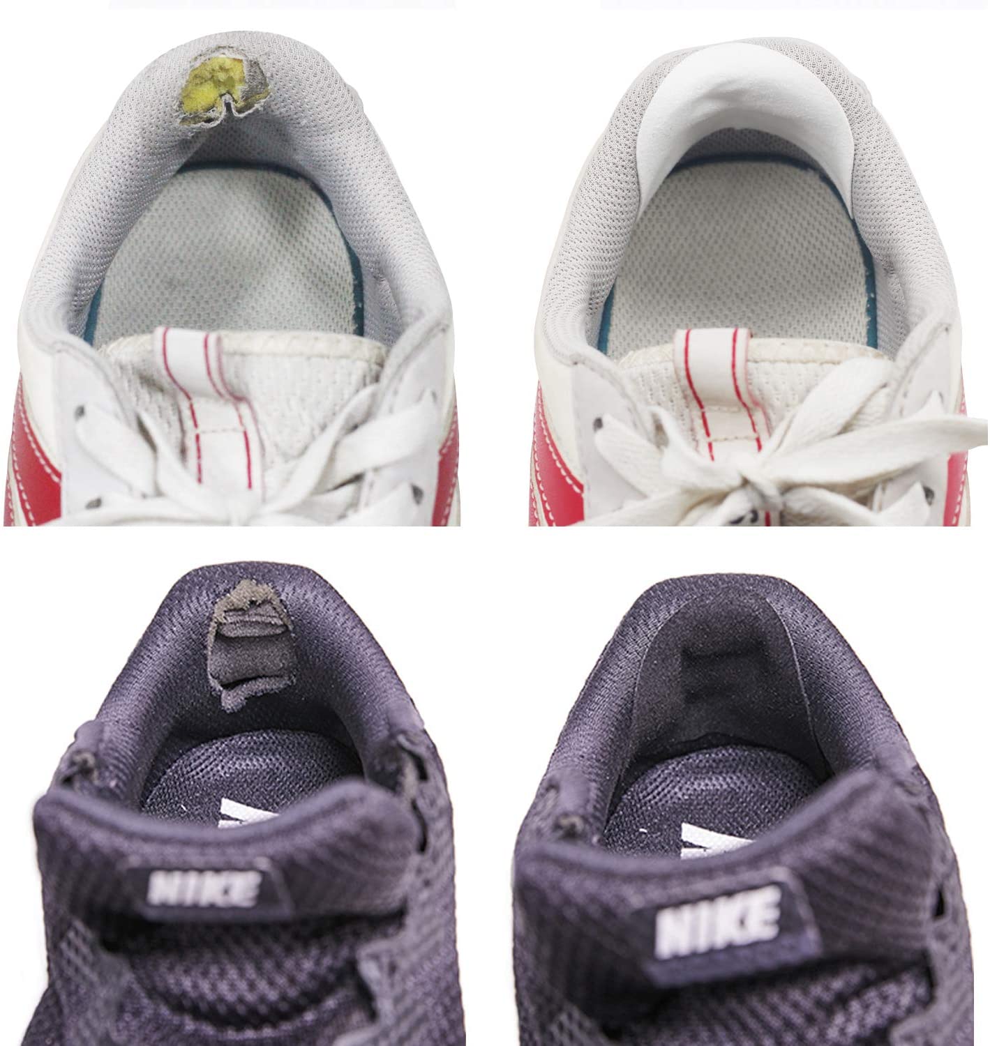 Sneaker Hole Repair，Shoe Heel Wear Hole 