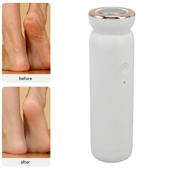 Callus Remover For Feet 5 Speed Adjustable Electric Foot File Pedicure Tool Electric Callus Remover USB Rechargeable Hard Skin Callus Remover For Dead Dry Skin And Cracked Heels