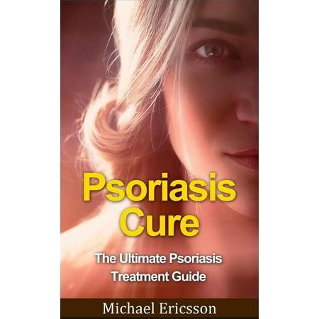 Psoriasis Cure The Ultimate Psoriasis Treatment Guide Ebook