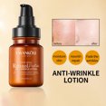 thumbnail image 4 of Xihbxyly Oferta de iluminación Leche esencial antiargugas en retinol, líquido hidratante, hidratante duradero, ligero, de fácil absorción, 100 ml, 4 of 7