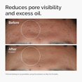 thumbnail image 2 of 2 PACK 1 Fl Oz Niacinamida 10% + Zinc 1%, Suero suavizante para piel propensa a las imperfecciones, 2 of 4