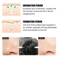 thumbnail image 4 of Wmkox8yii Parche hidrocoloide para espinillas de acné en los poros de la nariz y parche para poros de aceite que absorbe la mucosidad nasal del acné Wmkox8yii FJKAFA2331, 4 of 9
