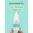 thumbnail image 3 of Serum Rael Miracle Clear, tratamiento completo para el acné, 30 ml, 3 of 6