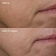 thumbnail image 3 of Sérum Dermalogica Phyto-Nature reafirmante antienvejecimiento 40 ml, 3 of 6