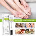thumbnail image 2 of Gel Anti Infección Paroniquia Tratamiento Toe Health Cuidado de los pies Tmvgtek cuidado belleza, 2 of 9