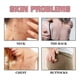 thumbnail image 3 of Jaysuing Exfoliating Bath Soap Smallpox Diluting Acne Removing Exfoliating Moisturizing Skin Cleaning Soap - 80G |, 3 of 4