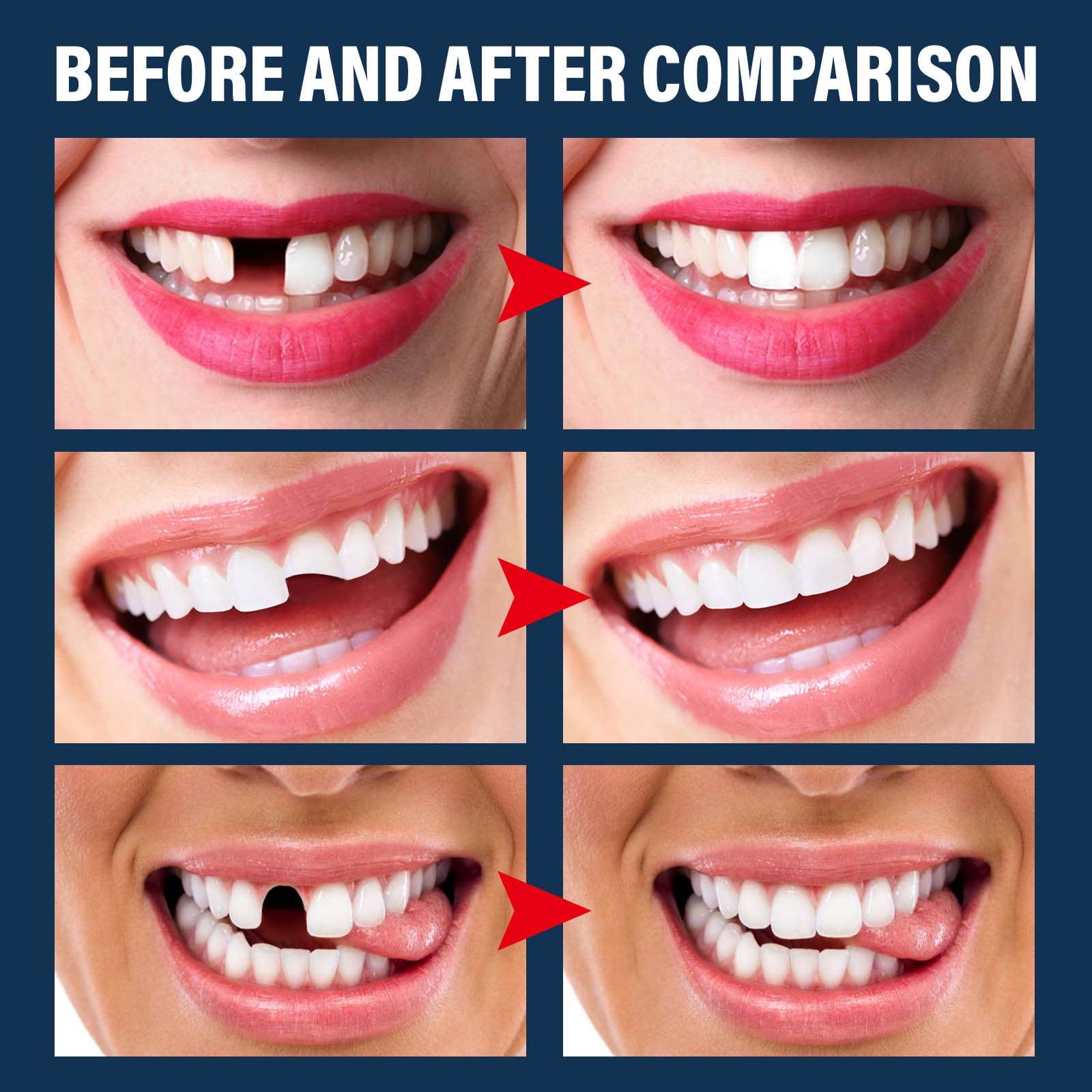 Alvantor Temporary Teeth Replacement Kit, DIY Halloween Vampire Teeth Decorative Cosplay Set