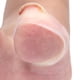 thumbnail image 5 of Fugacal Pegatinas de corrección de u?as, 2 piezas Herramienta de cuidado de pies corrector de u?as encarnadas de silicona para paroniquia Recuperación de herramientas de cuidado de u?as curativas Fugacal No se aplica, 5 of 6