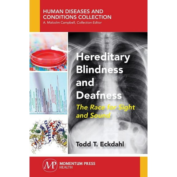 Hereditary Blindness and Deafness: The Race for Sight and Sound, (Paperback)