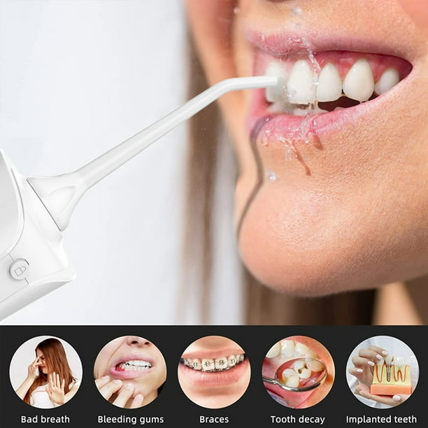 Irrigador Oral Limpieza Dental Portatil Inalambrico VBG vbg-irrigadorporta | Walmart en línea