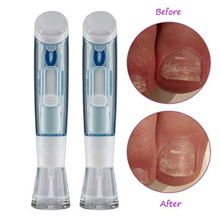 Nail Toe Fungal Treatment Specially Formulated Serum, Applicator and Disposable Files Nail Treatment Fungal Fungus Kit (1 Pack)