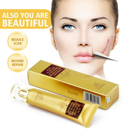 30g Scar Acne Mark Removal Ointment Gel Face Pore Skin Repair Stretch Marks Cream (Best Makeup To Cover Acne Scars 2019)