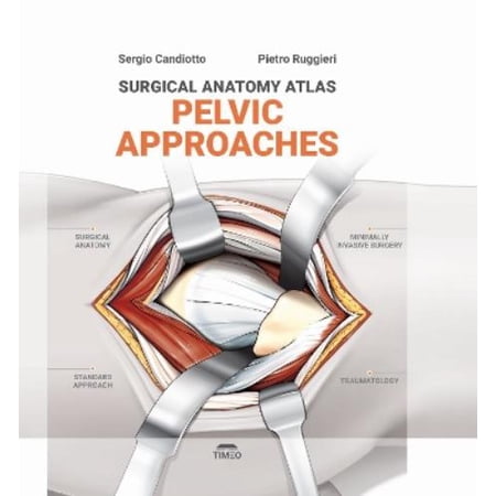 Sergio Candiotto Pietro Ruggieri Pelvic Approaches (Hardcover) Surgical Anatomy Atlas