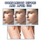thumbnail image 5 of Scar Removal Cream Scar Repair Cream Scar Removal And Skin Repair 50ml, 5 of 9