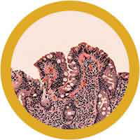 Giant Microbes Original Plush Giantmicrobes Celiac Disease **Turns Inside Out** 