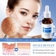 thumbnail image 5 of Esencias para el cuidado de la piel, serie 30 ml, blanqueadoras, hidratantes, rejuvenecedoras y humectantes Autorización, 5 of 8
