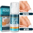 thumbnail image 1 of 2pcs Scar Cream Gel Scar Removal Care Cream Gel Skin Repairs Cream For Improving Skin Scar, 1 of 1