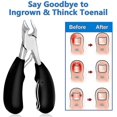 thumbnail image 1 of Toe Nail Clippers For Thick Or Ingrown Nails Heavy Duty Stainless, 1 of 3