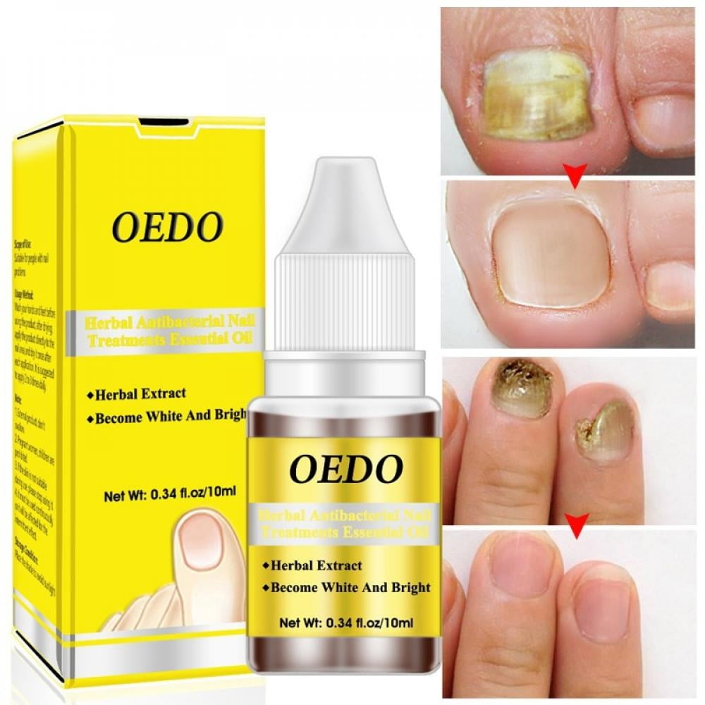Elaydool Big Clear 10ML Nail Fungal Treatment Onychomycosis Removal Anti Fungus Nails Care