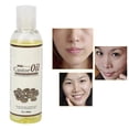thumbnail image 1 of Castor Massage Oil, Body Castor Massage Oil Relieving Moisturizing  For Home, 1 of 8