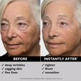 thumbnail image 2 of 3,53 Onzas Apretador facial temporal Instant, Firme y alise la apariencia de las líneas finas, arrugas profundas y poros, 2 of 5